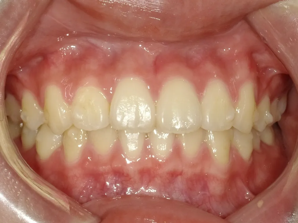 CASE4