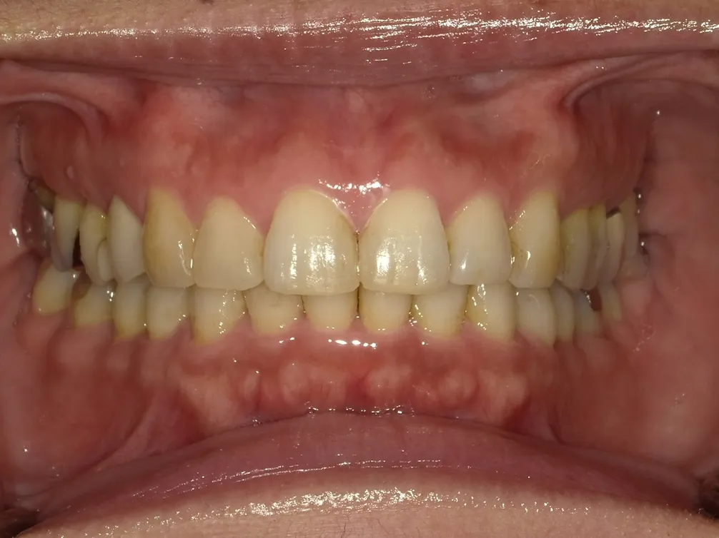 CASE17