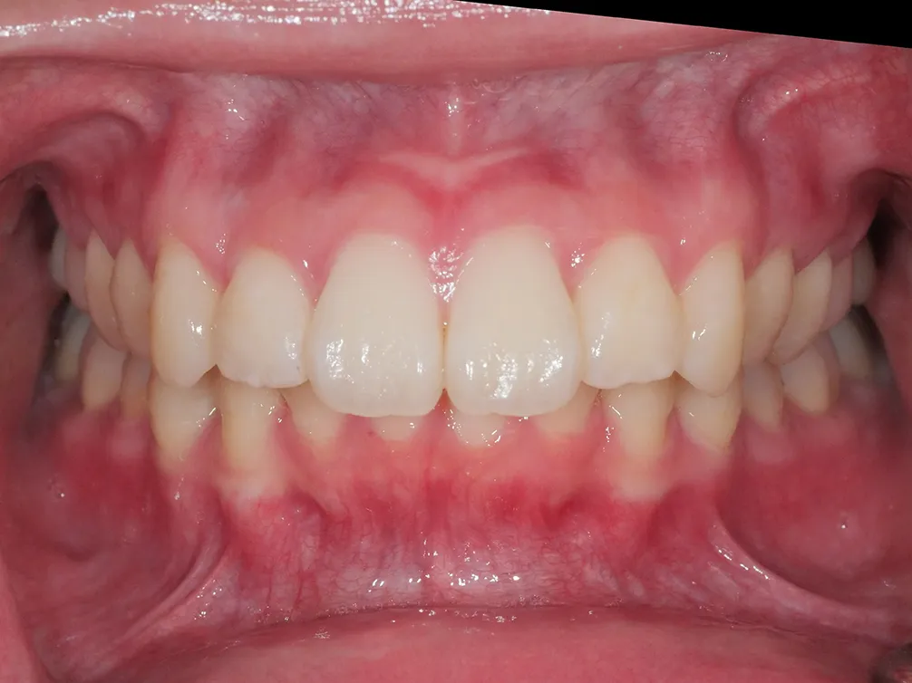 CASE10