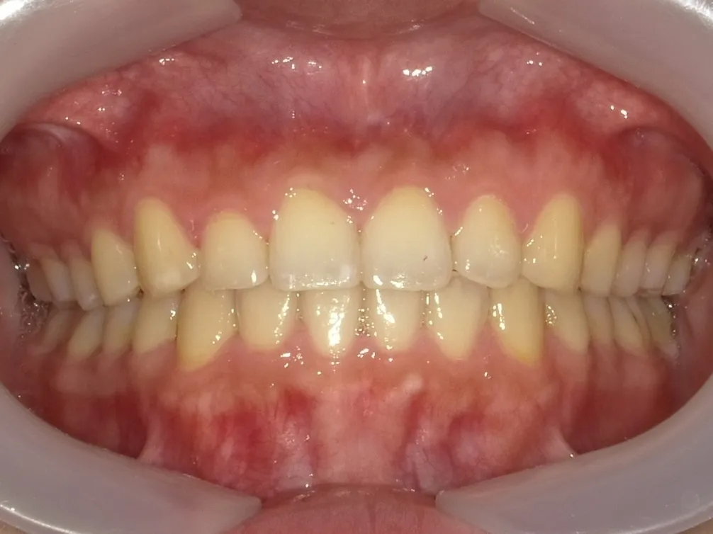 CASE19