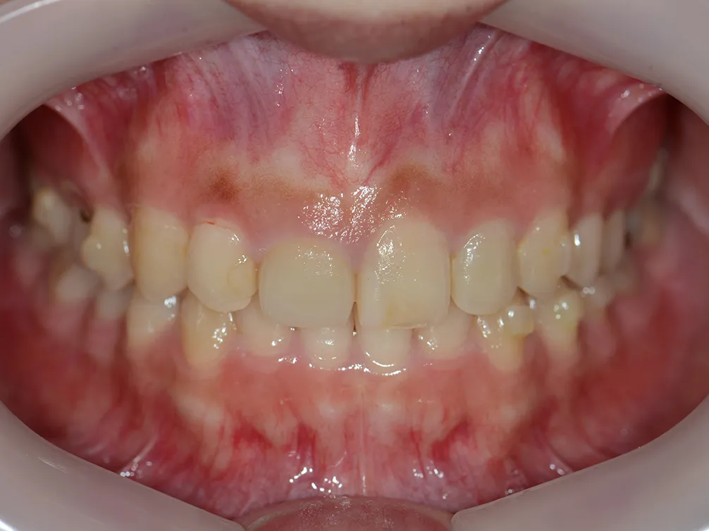 CASE02