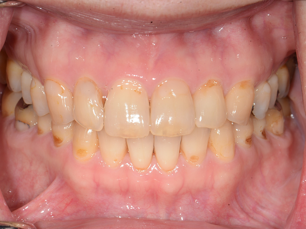 CASE20