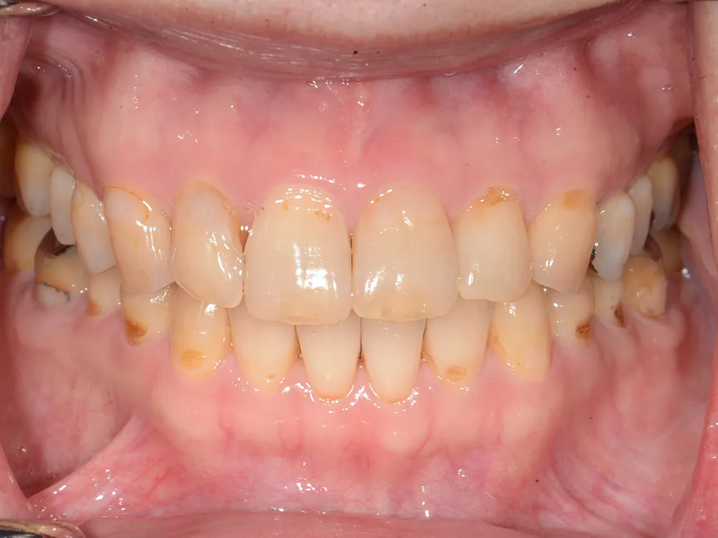 CASE20