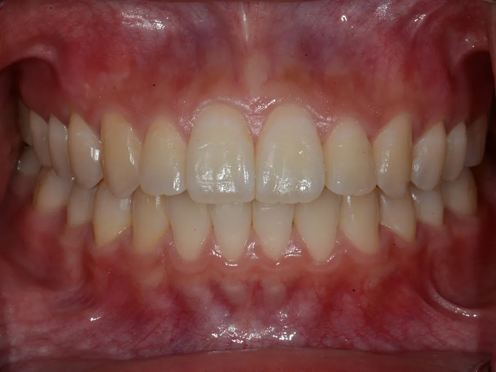 CASE12