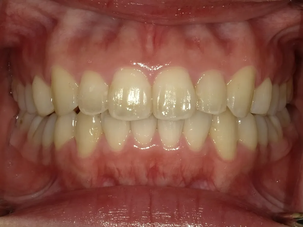 CASE7