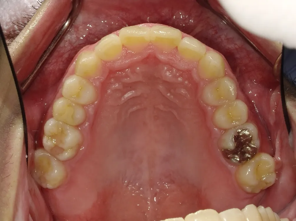 CASE5