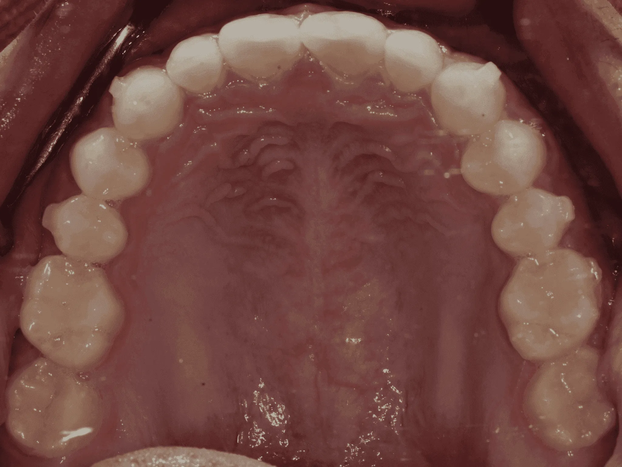CASE16