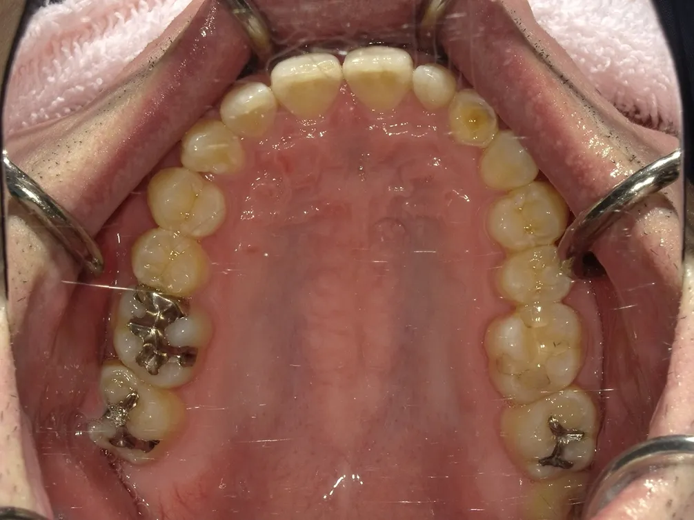 CASE28
