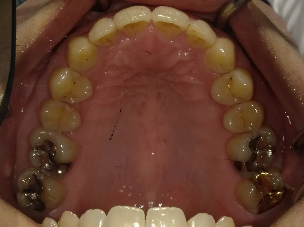 CASE16