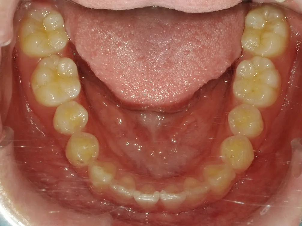CASE4