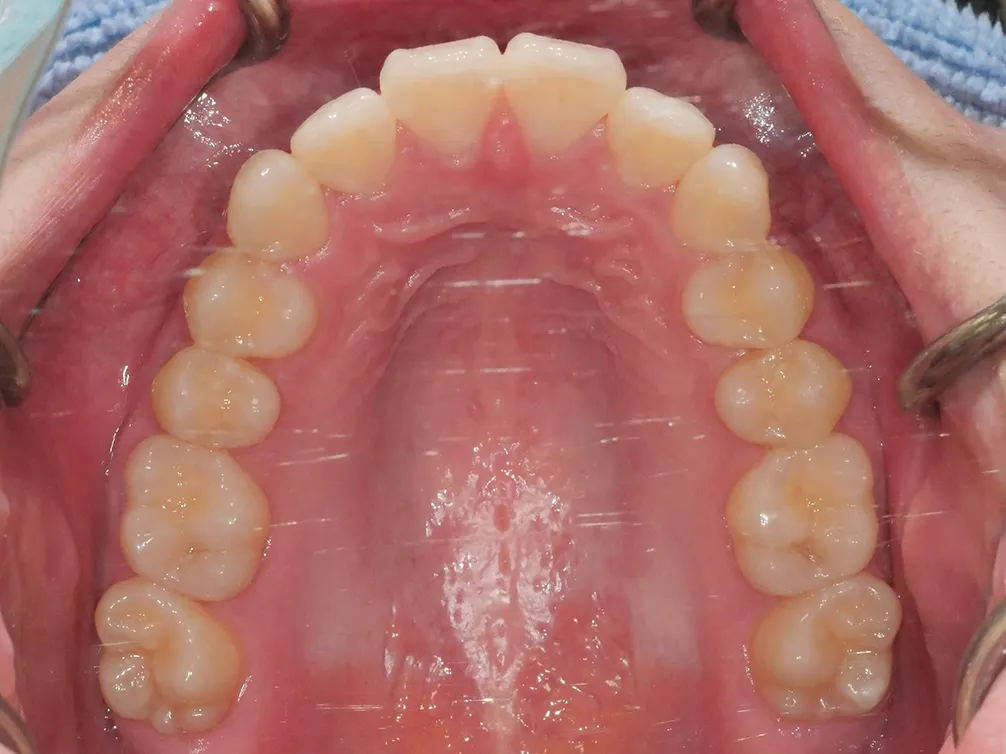 CASE10