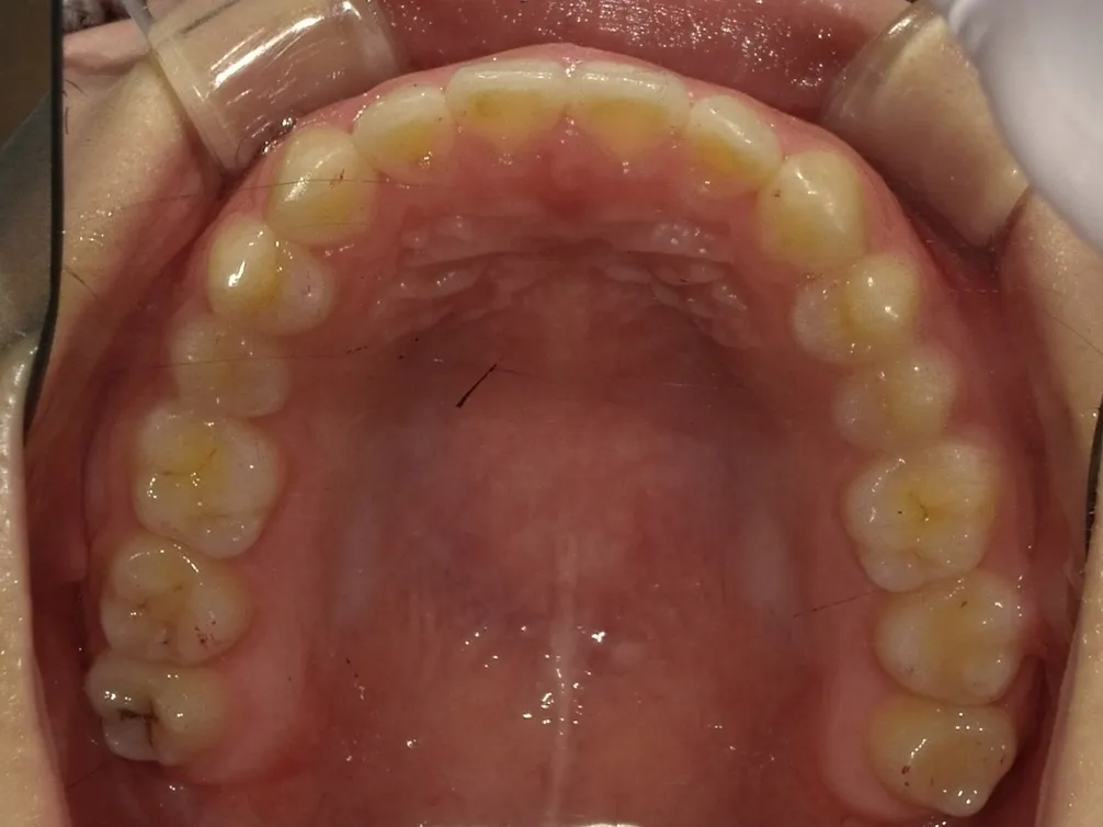 CASE19