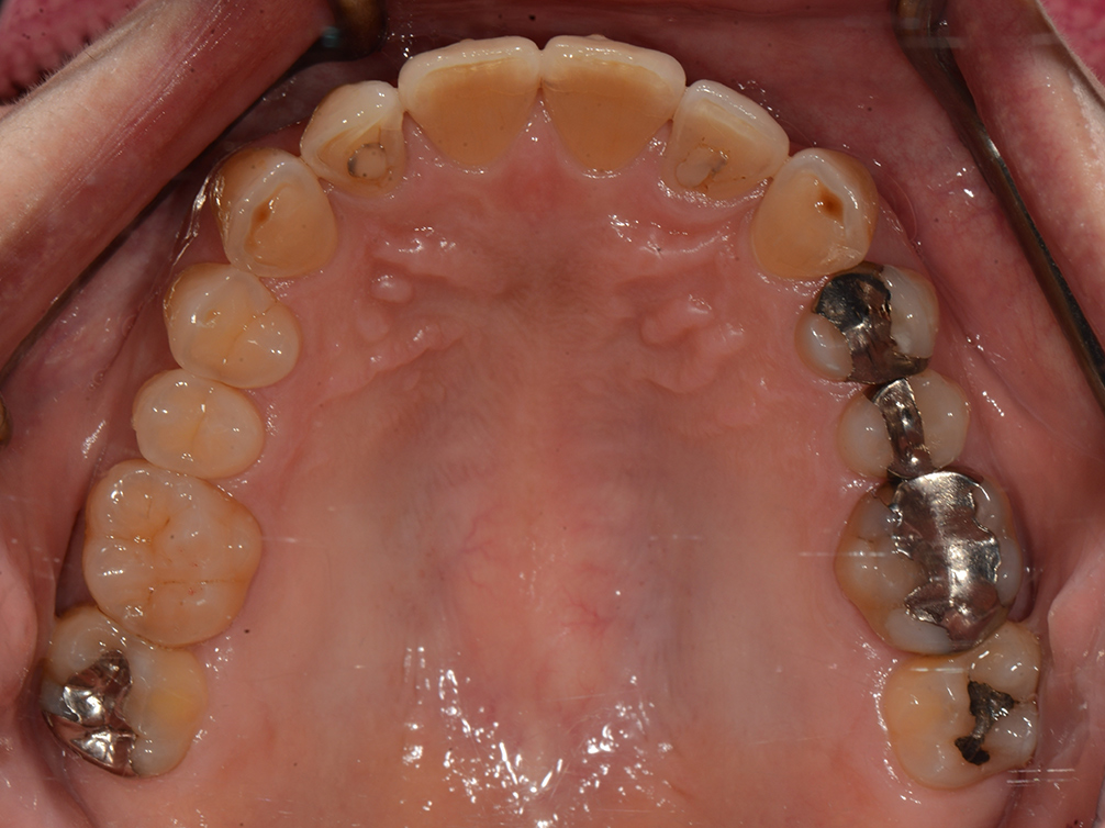 CASE20