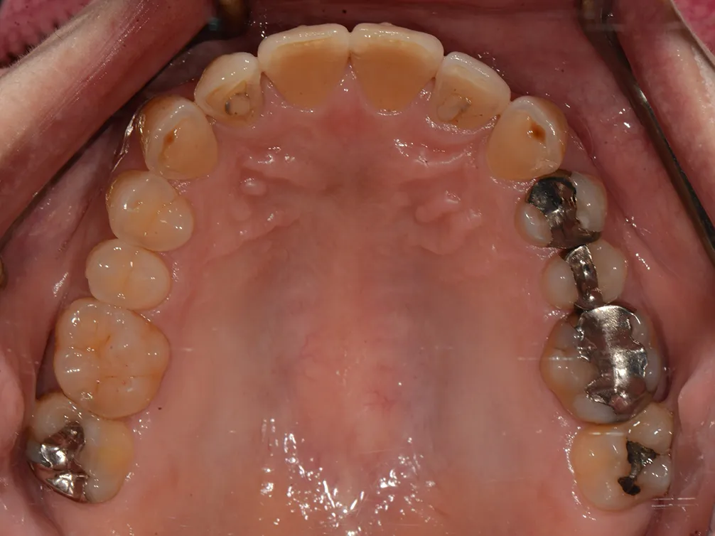 CASE20