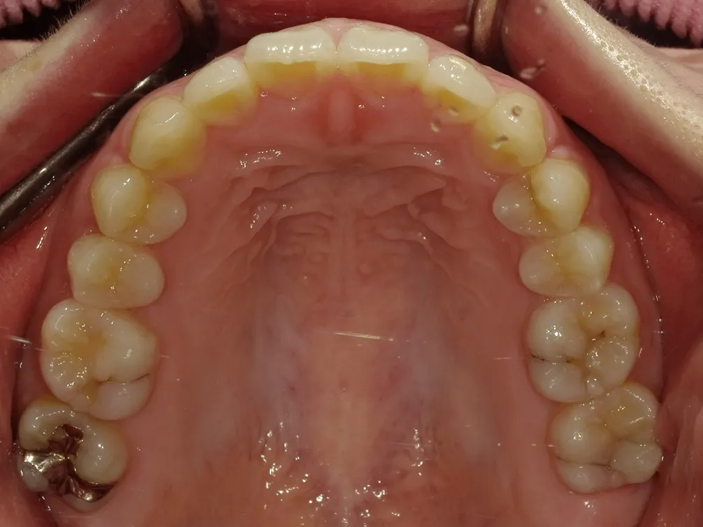 CASE6