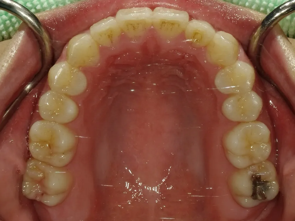 CASE7