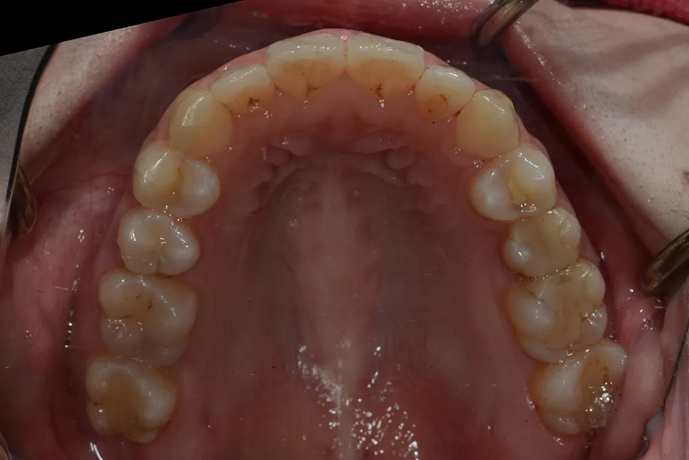 CASE27