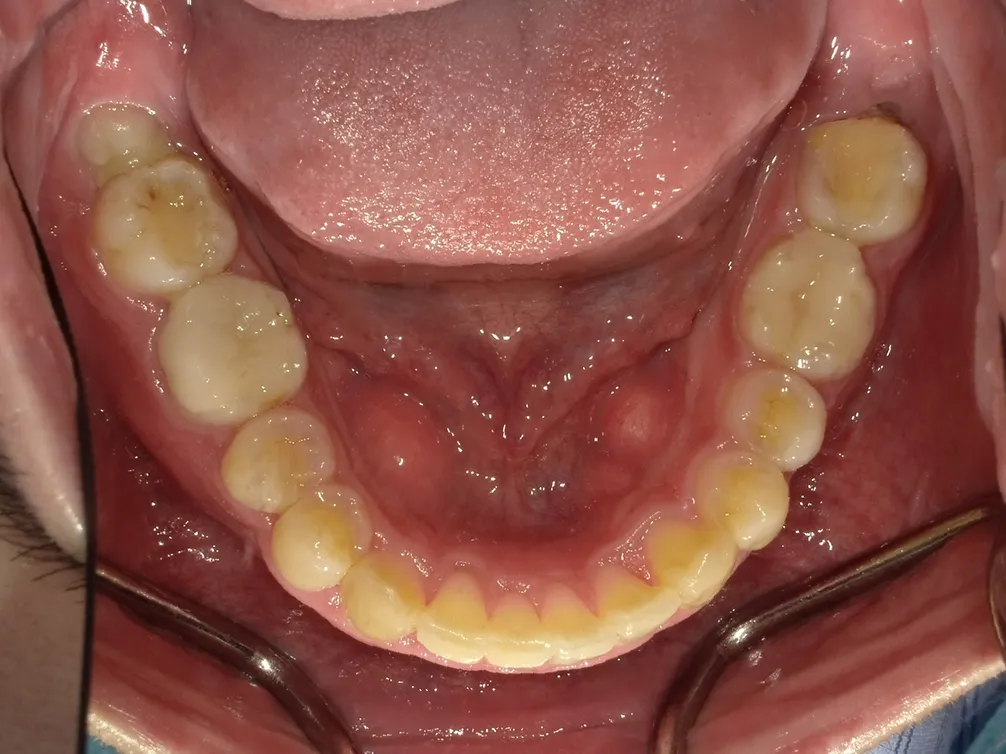 CASE5