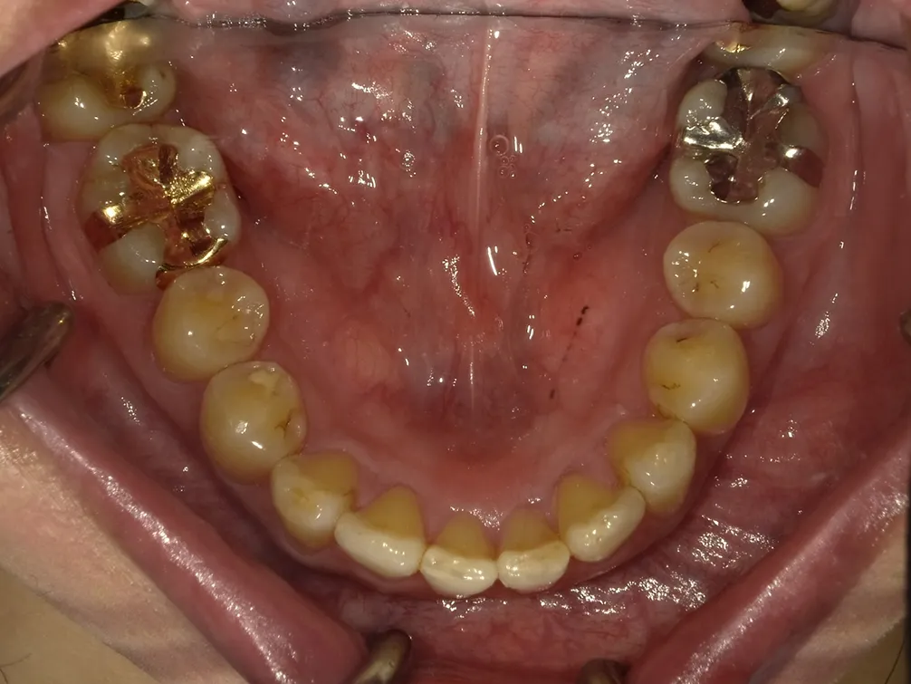 CASE16