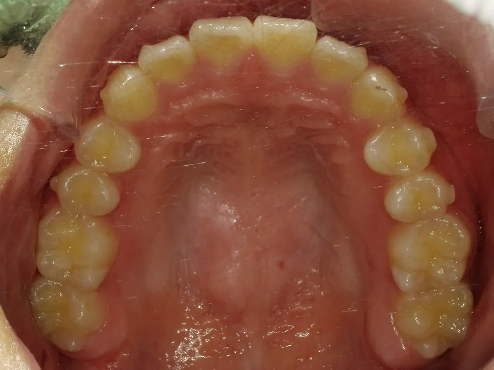 CASE4