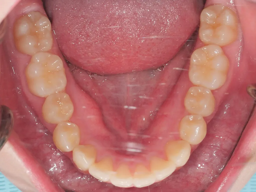 CASE10