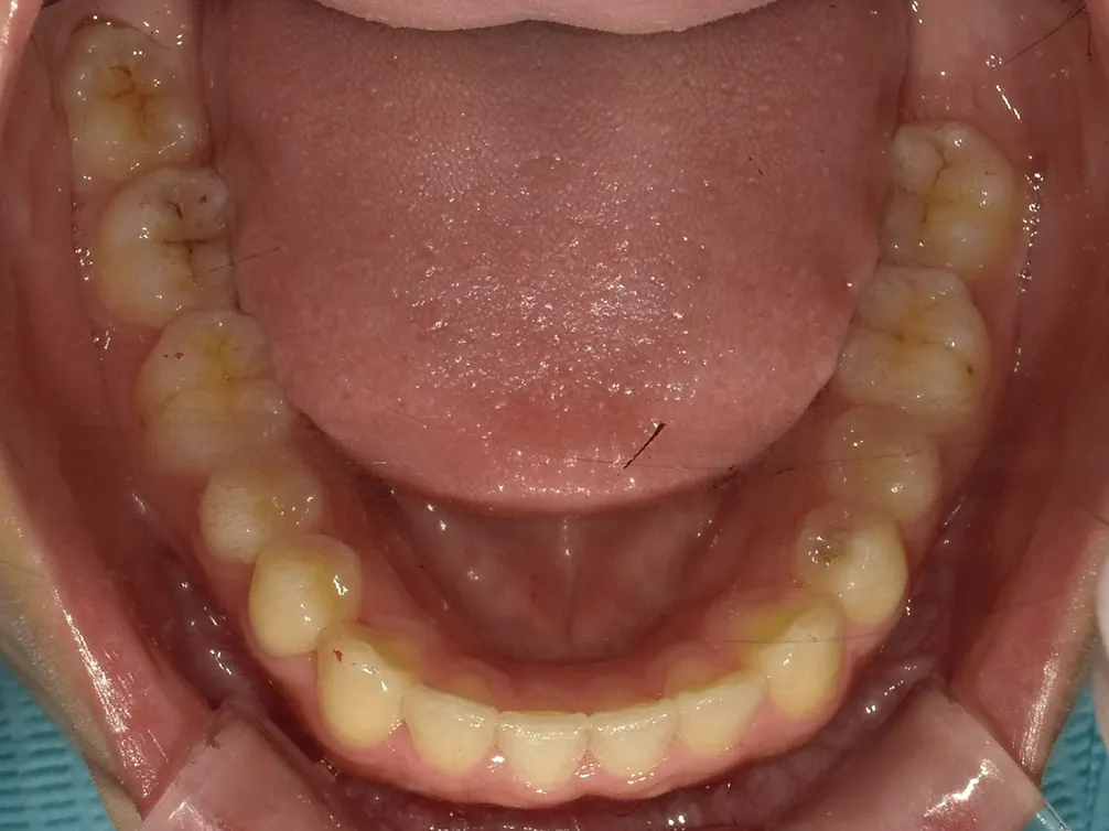 CASE19