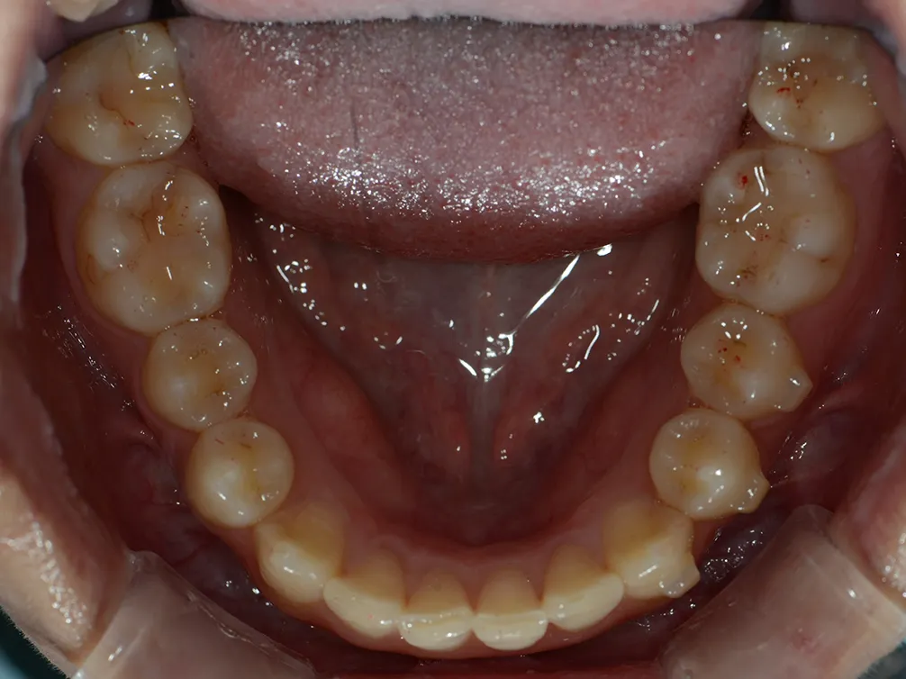 CASE02