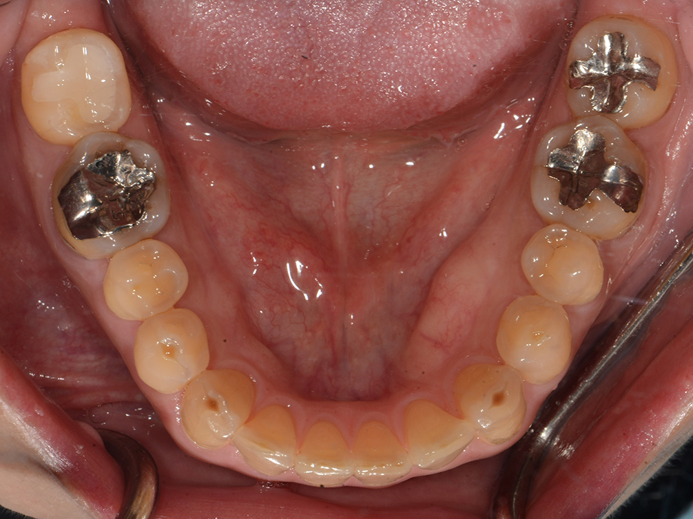 CASE20