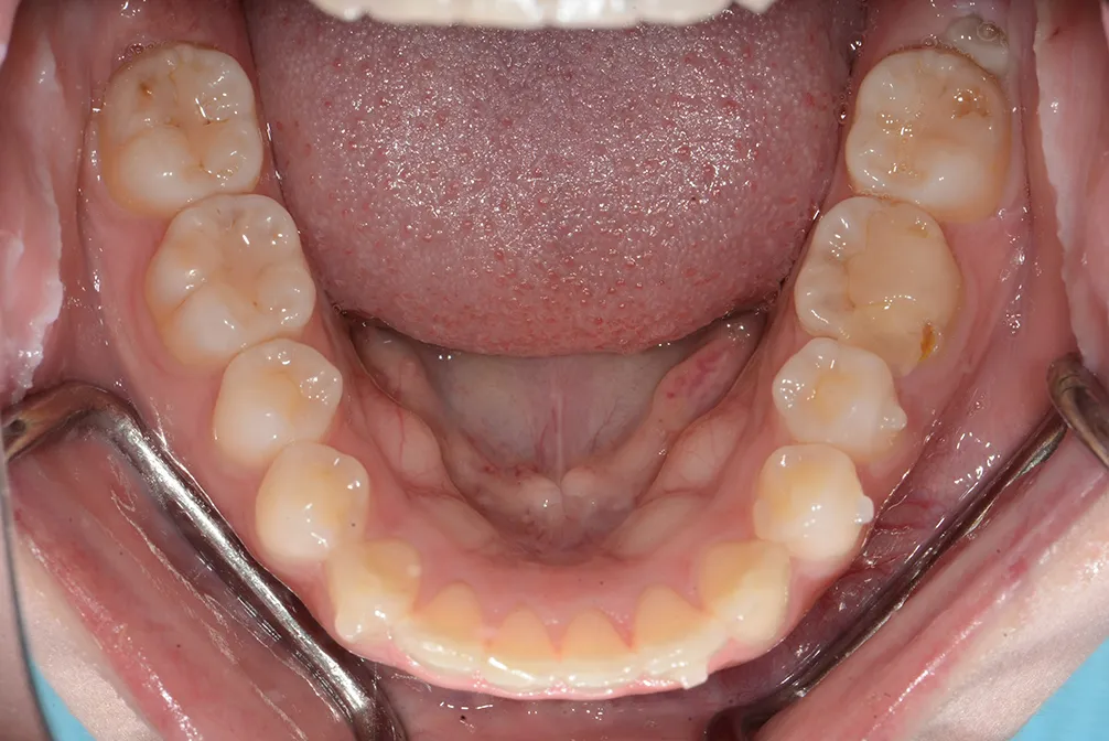 CASE26