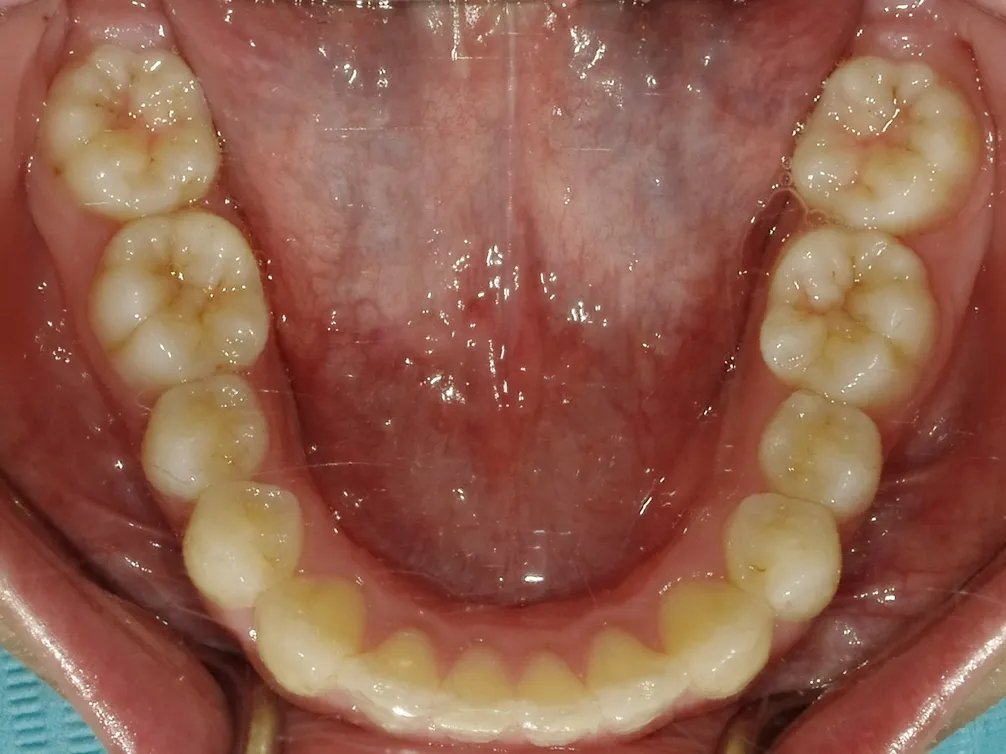 CASE7