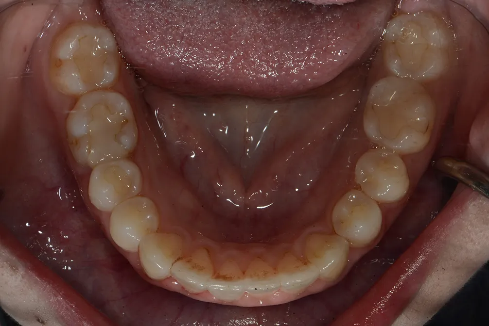CASE27