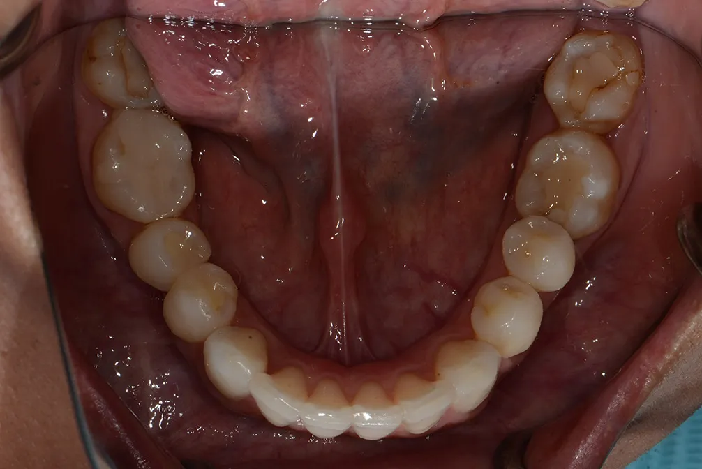 CASE18