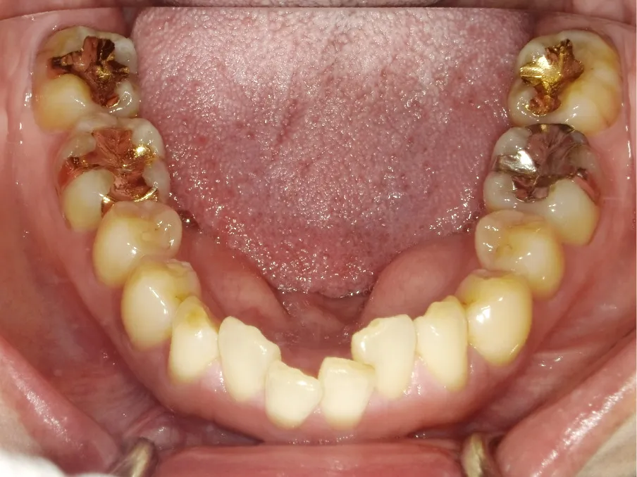 CASE09