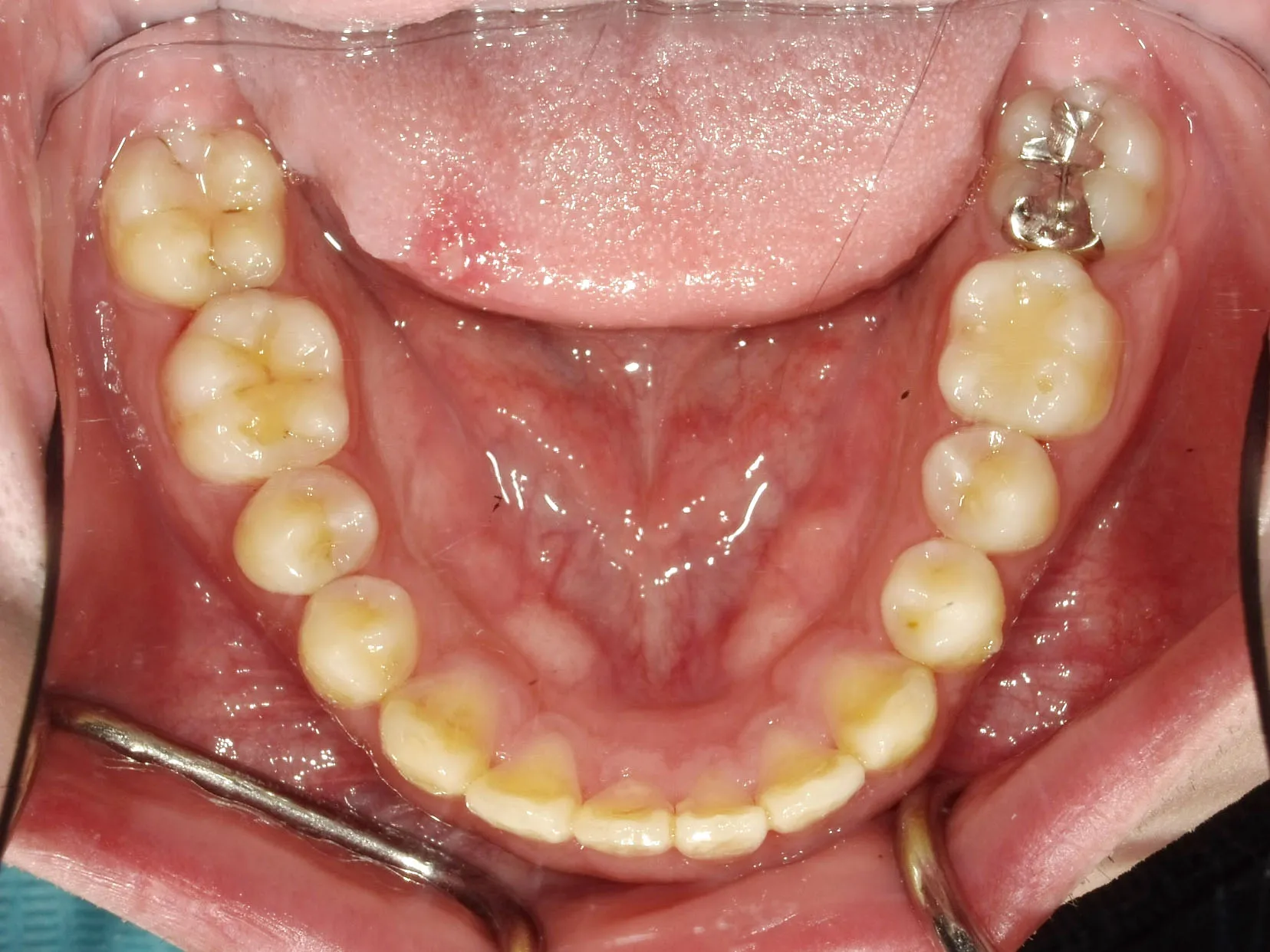 CASE10