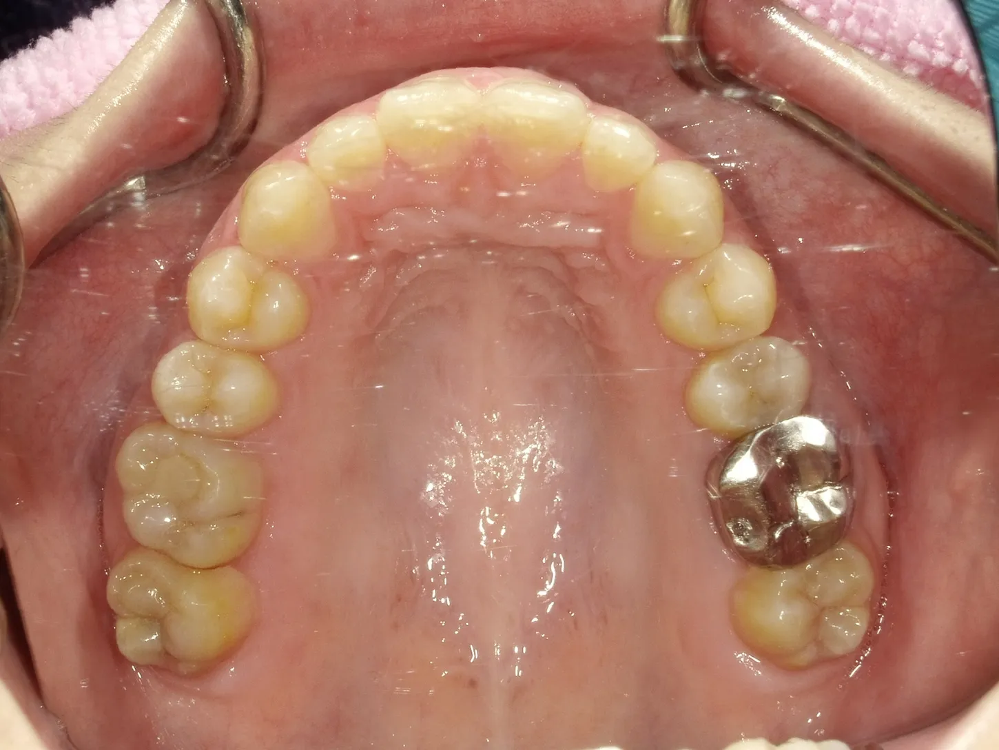 CASE12