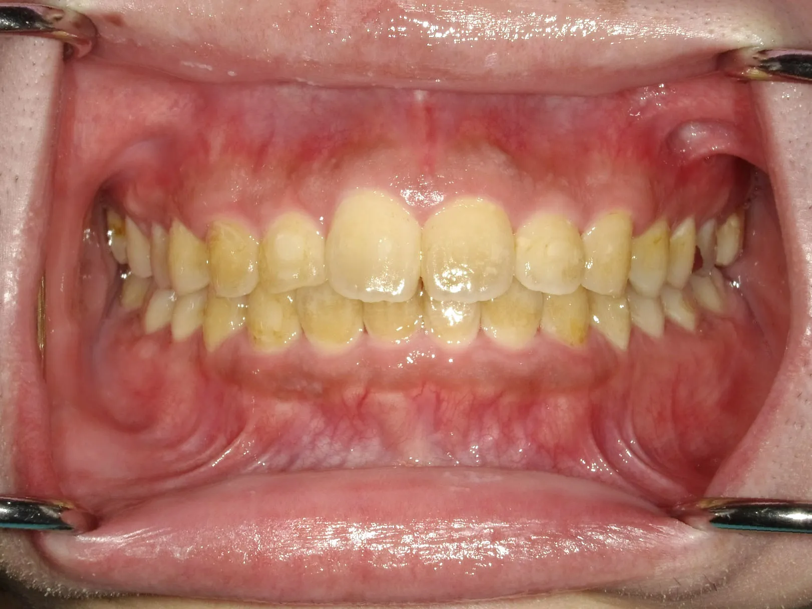 CASE10