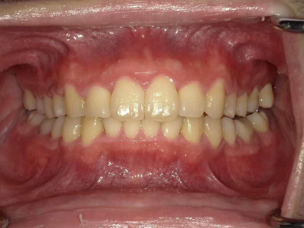 CASE5