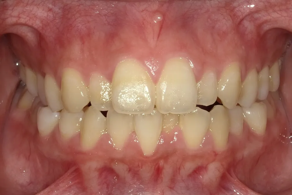 CASE27