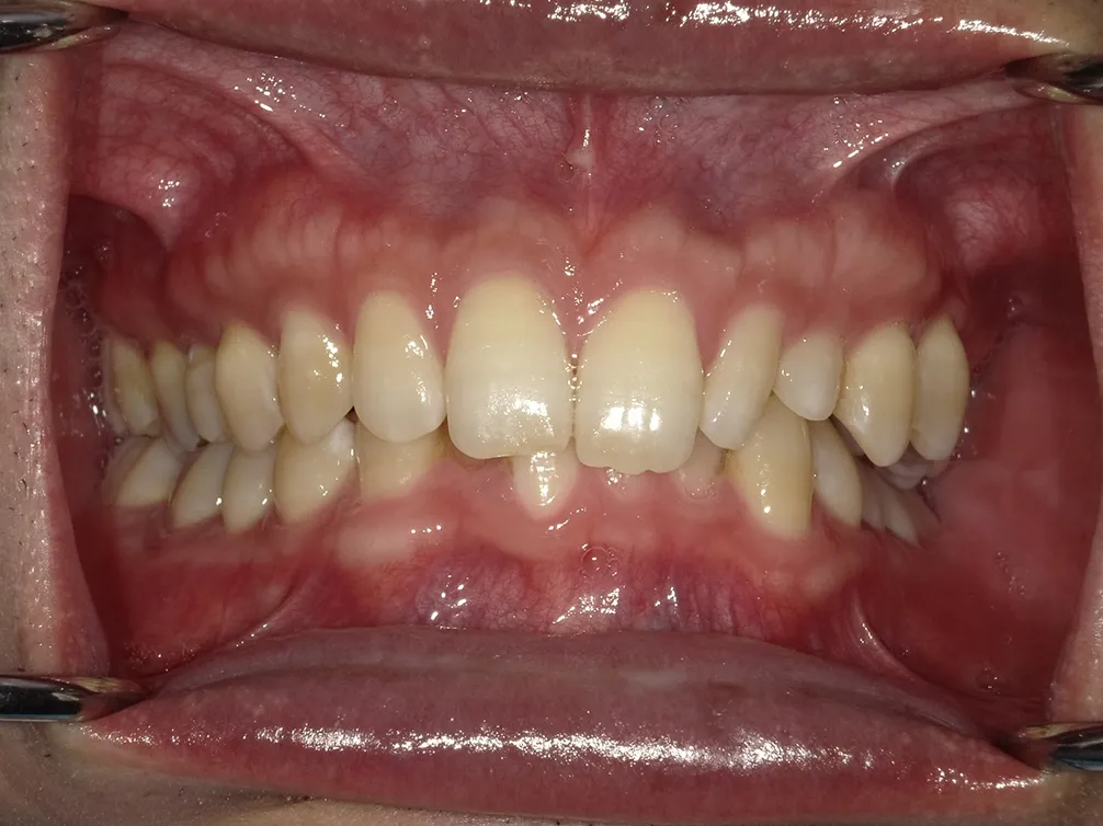 CASE28