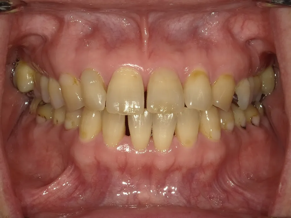 CASE18