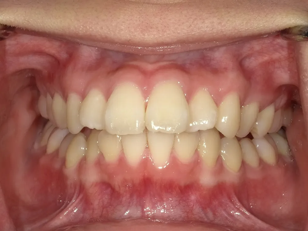 CASE10