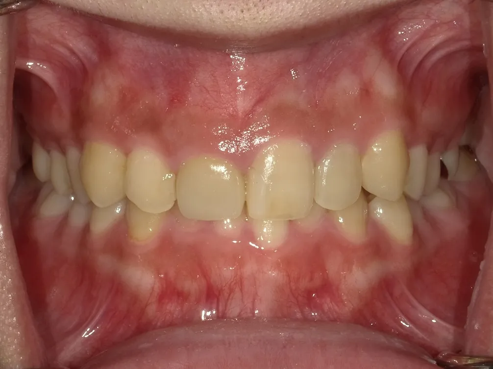 CASE02
