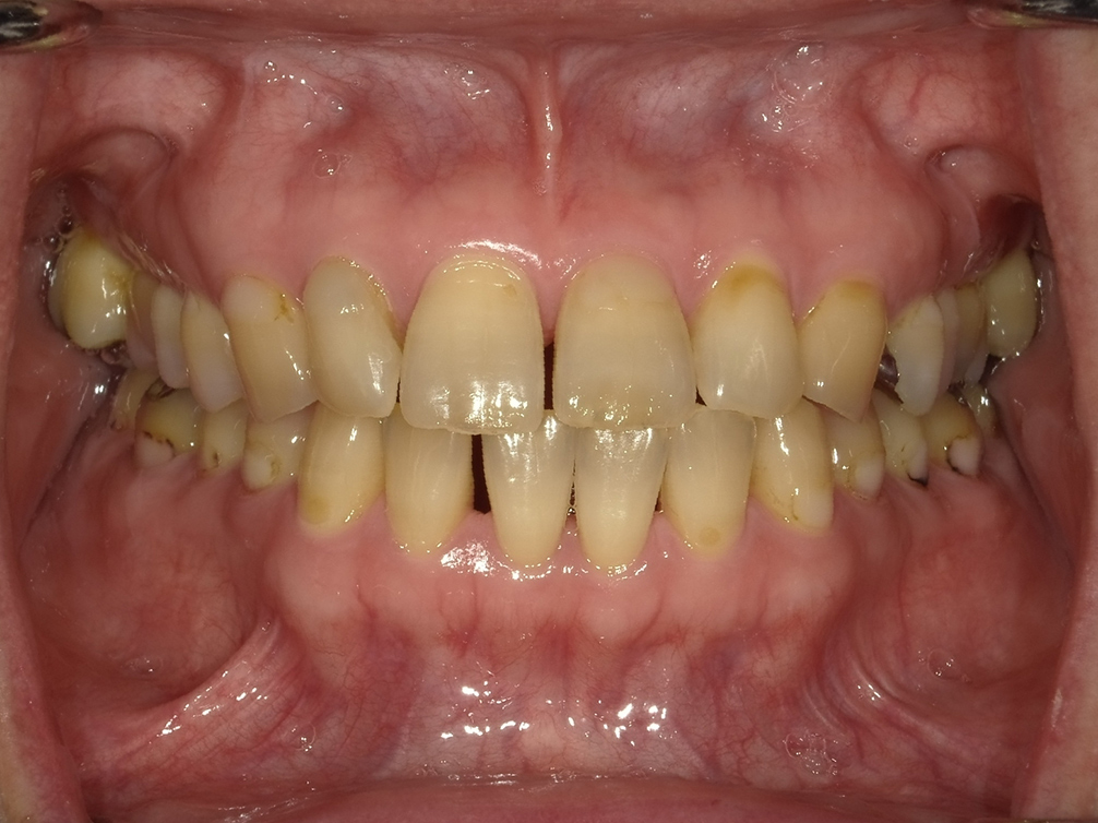 CASE20