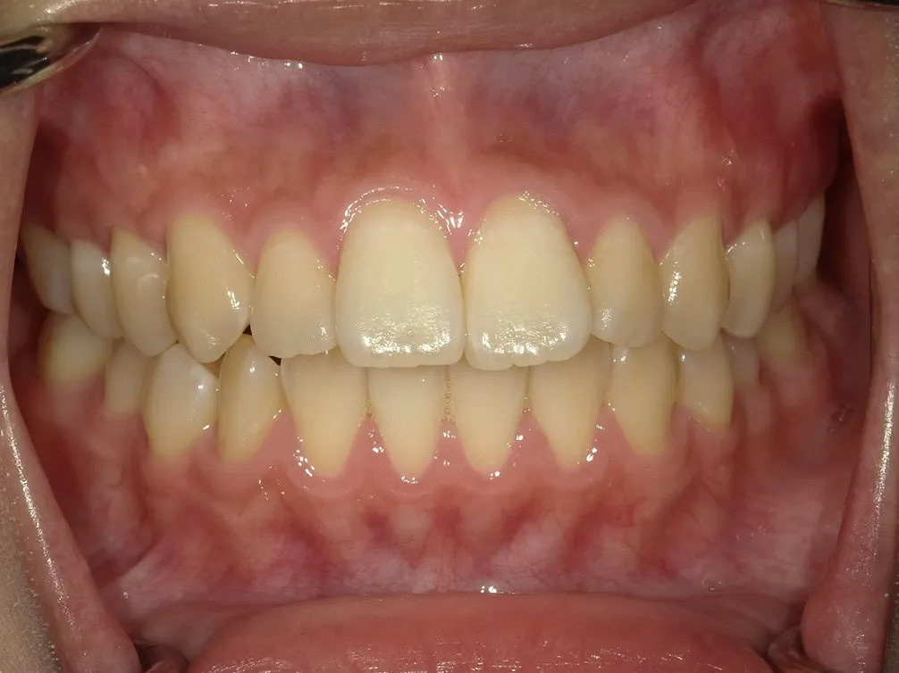 CASE12