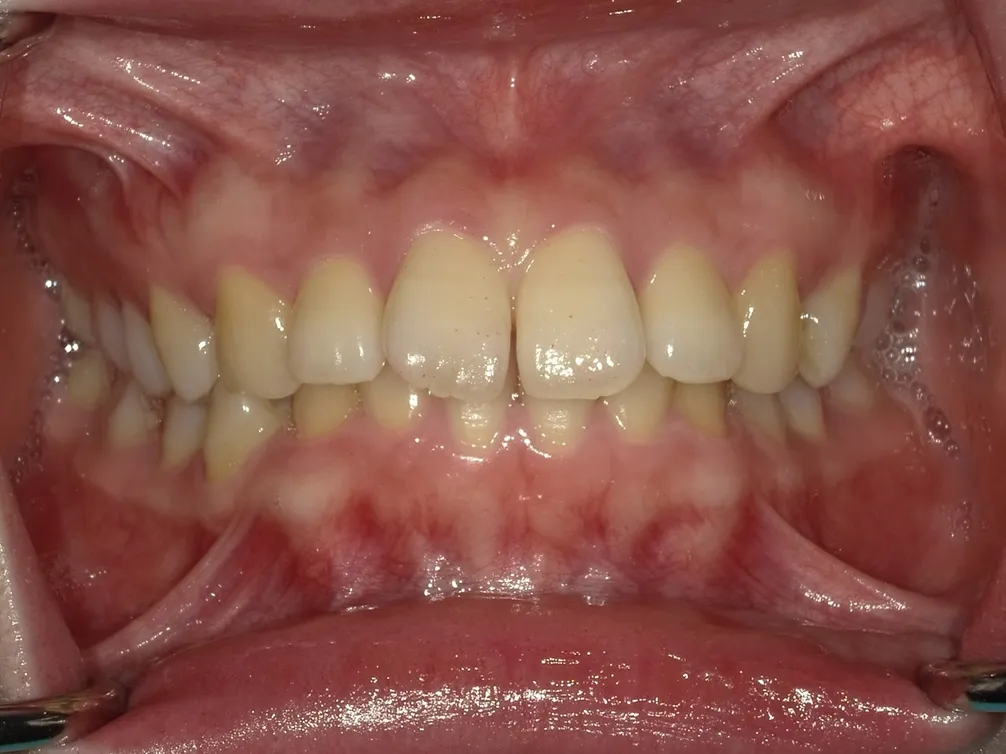 CASE6