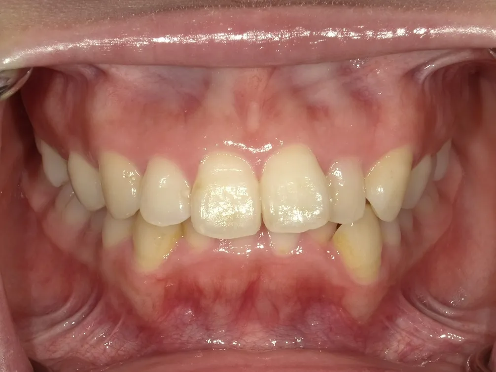 CASE7