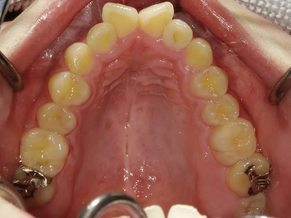 CASE21