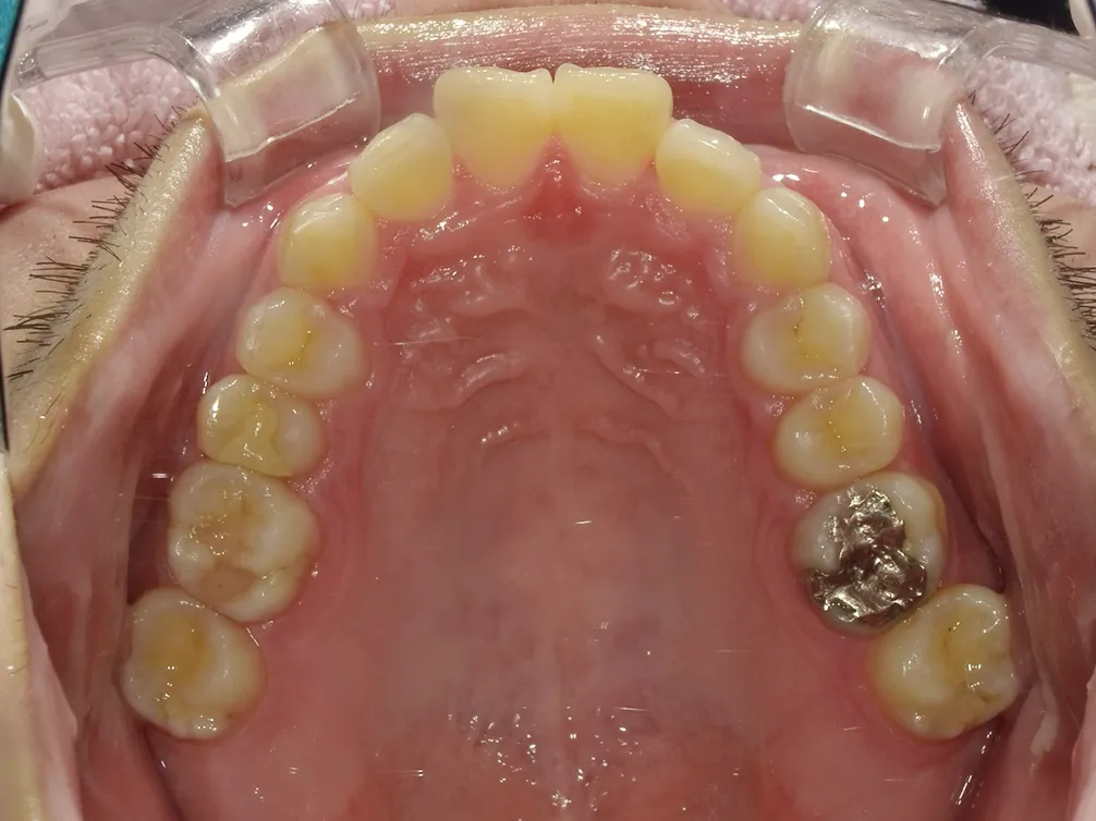 CASE5