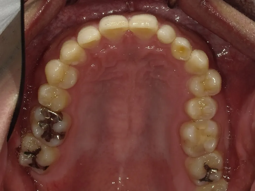 CASE28