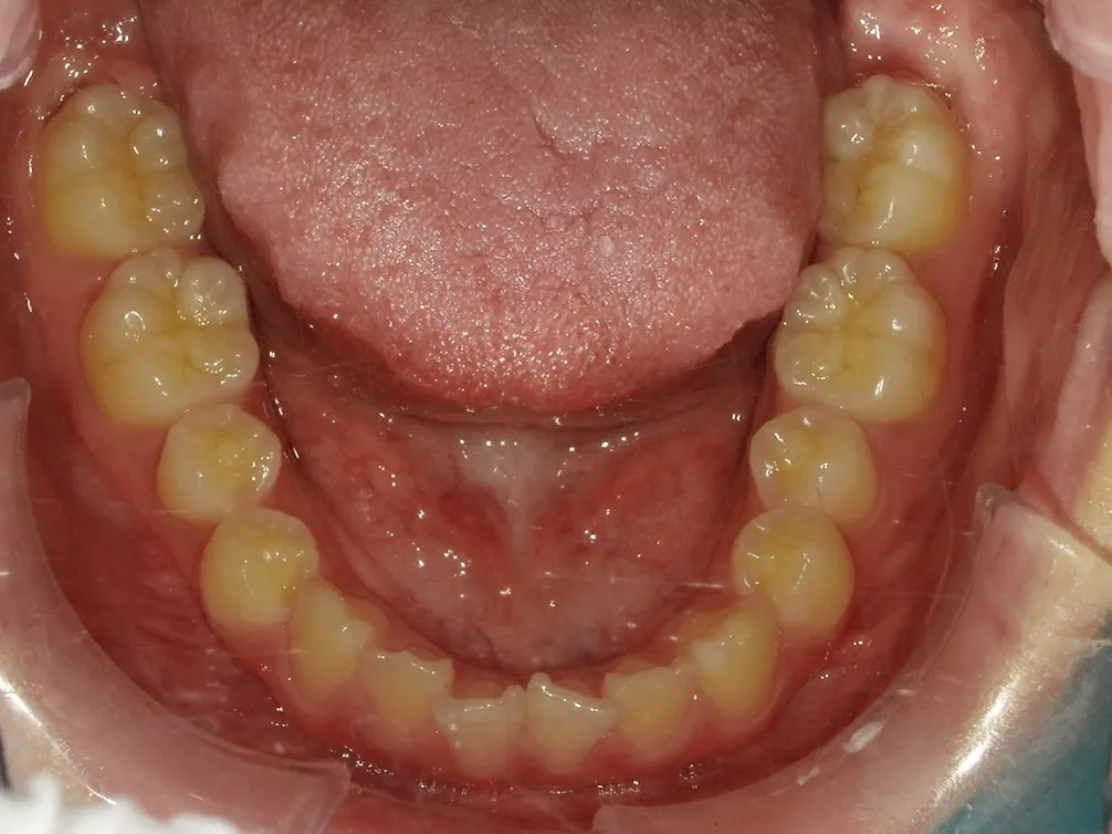 CASE4
